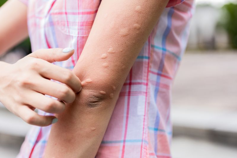Stinging Insect Extermination